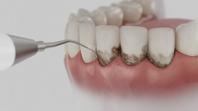Reliable Dental contractor in Dover, OH by Dentist Open Now